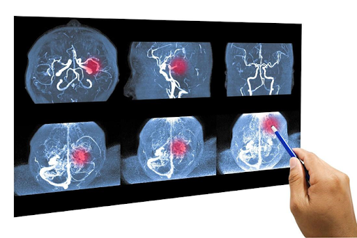 снимок мозга